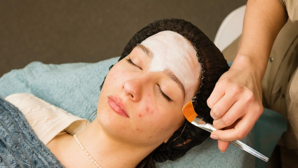 tratamiento anti acne